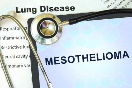 Mesothelioma Lawsuit