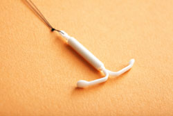 mirena iud birth control