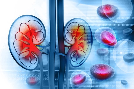 PrevAcid Kidney Failure