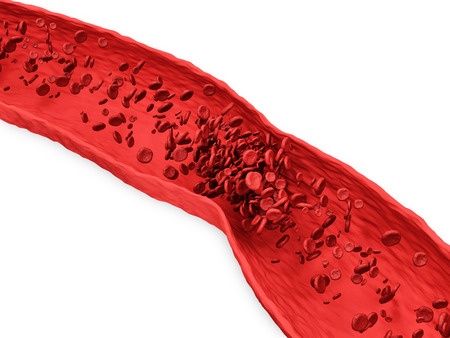 Testosterone Blood Clots