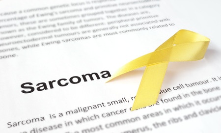 Uterine Sarcoma