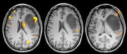 mri contrast agent dye